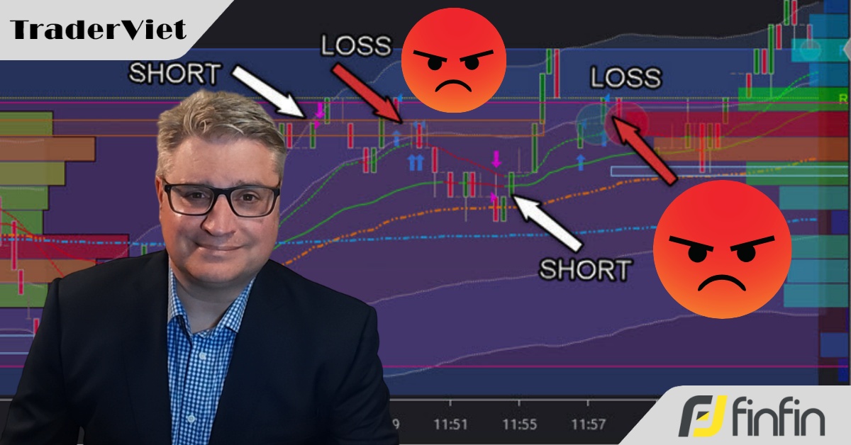 Tại sao bạn lại khiến trading trở nên khó khăn hơn mức cần thiết?