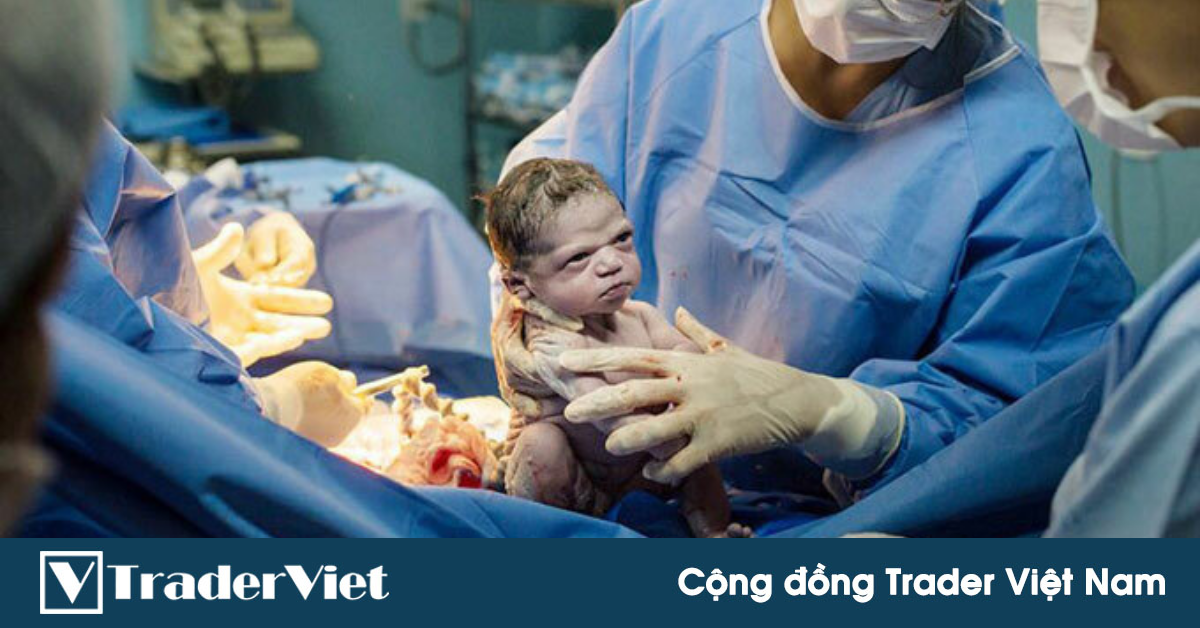 Điểm nóng MXH 26/08 - Cộng đồng Trader Việt Nam: Vừa sinh ra thì biết bố full mã CTG...